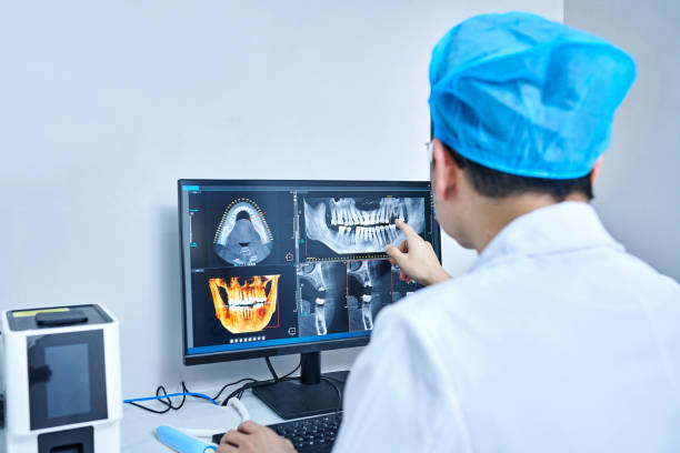 Best Knocked-Out Tooth (Avulsed Tooth) Treatment in De Motte, IN