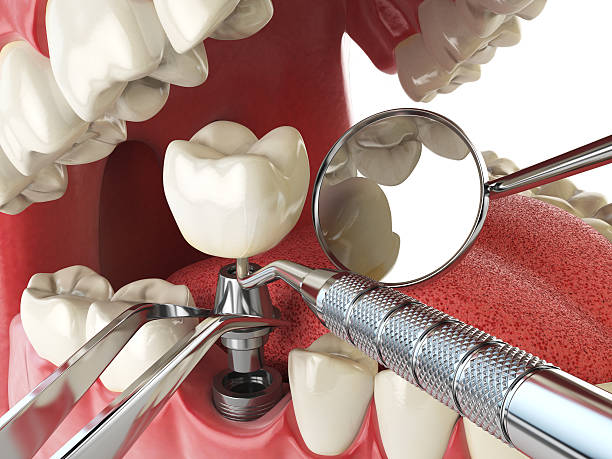 Best Emergency Treatment for Jaw Pain or Injury in De Motte, IN